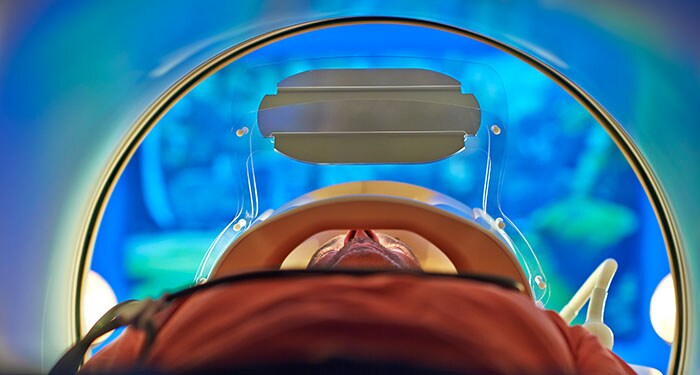 70% reduction in MRI rescans