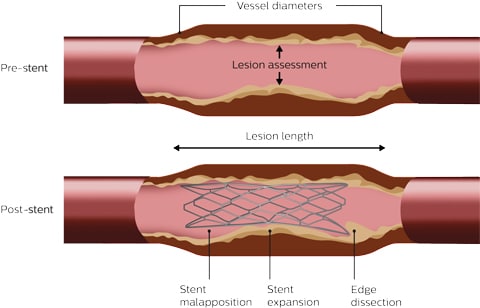 Interpretation illustration