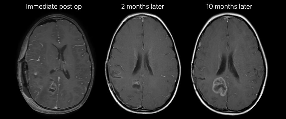 Follow-up over time results