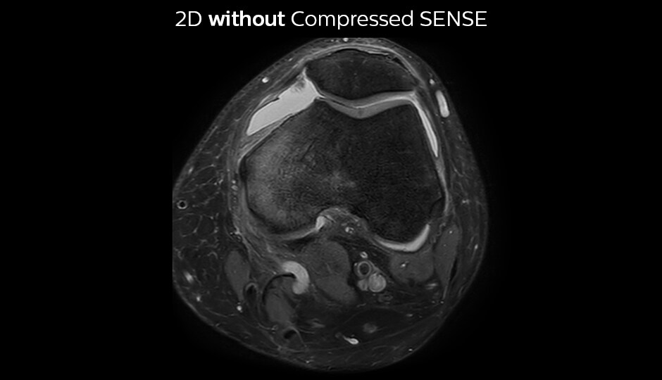 Compressed sense C3