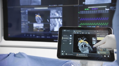 Flexible radiology workflow