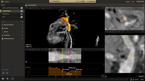 Flexible radiology workflow