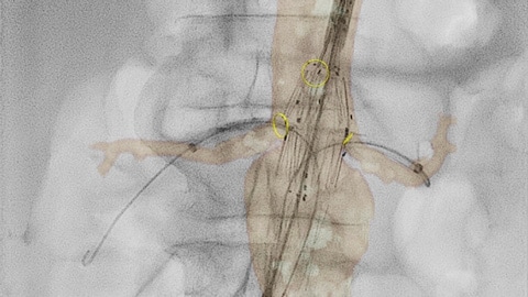 Flexible radiology workflow