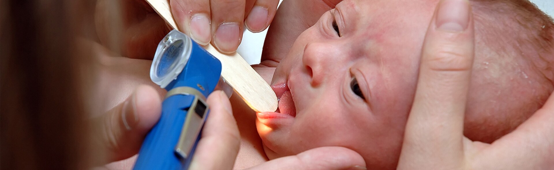 Understanding infant tongue Philips