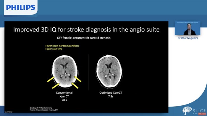 Dr Nogueira at SLICE 2020 virtual evet