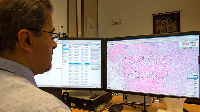 Digital pathology & Computational pathology went from “it will happen" to “it's happening right now” | Philips