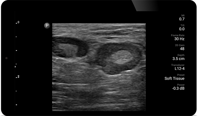 Ultrasound image