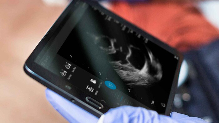 A Patient with Dyspnea