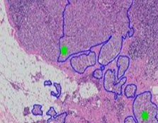 support-pathologists