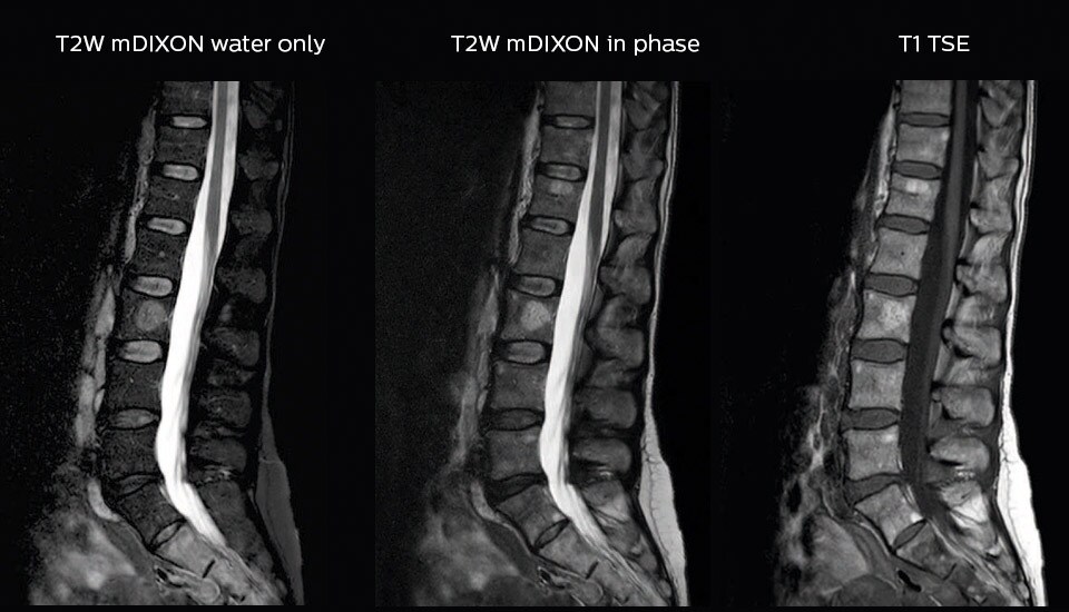 meander case image