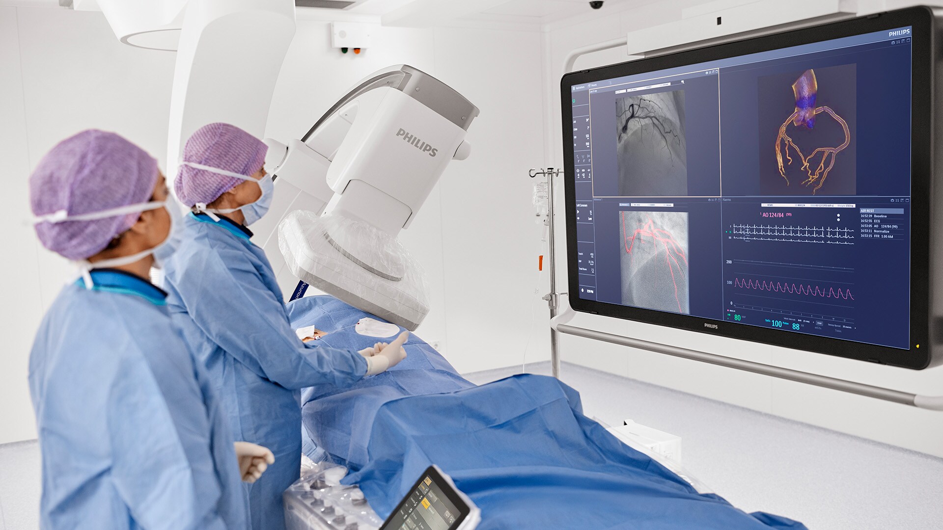 Philips introduces industry-first cath lab integration that automatically synchronizes pre-operative CT with C-arm movement, paving the way for CT-guided PCI